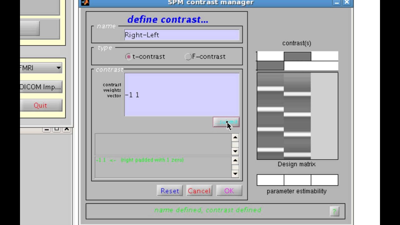 SPM Contrasts