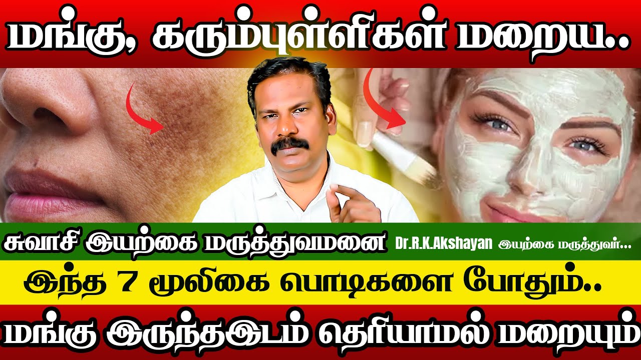 முகத்தின் மங்கு மறைய| mangu maraiya home remedy tamil | Dr.R.K.Akshayan