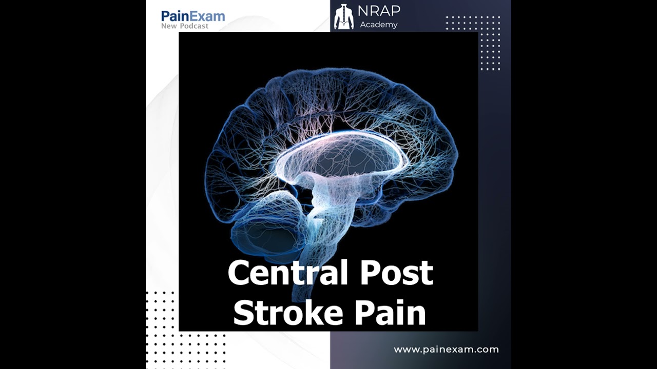 Central Post Stroke Pain