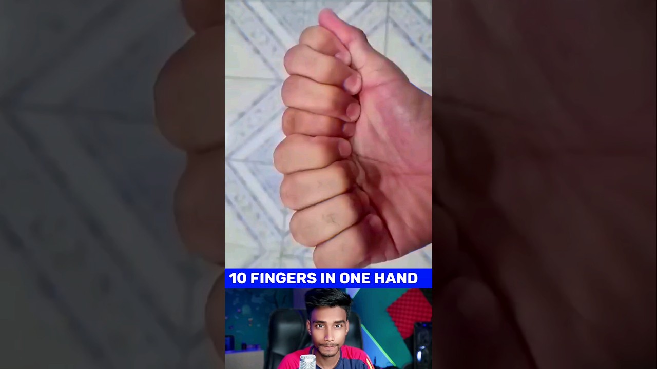10 Fingers in one Hand😨 | Unusual Viral Shorts