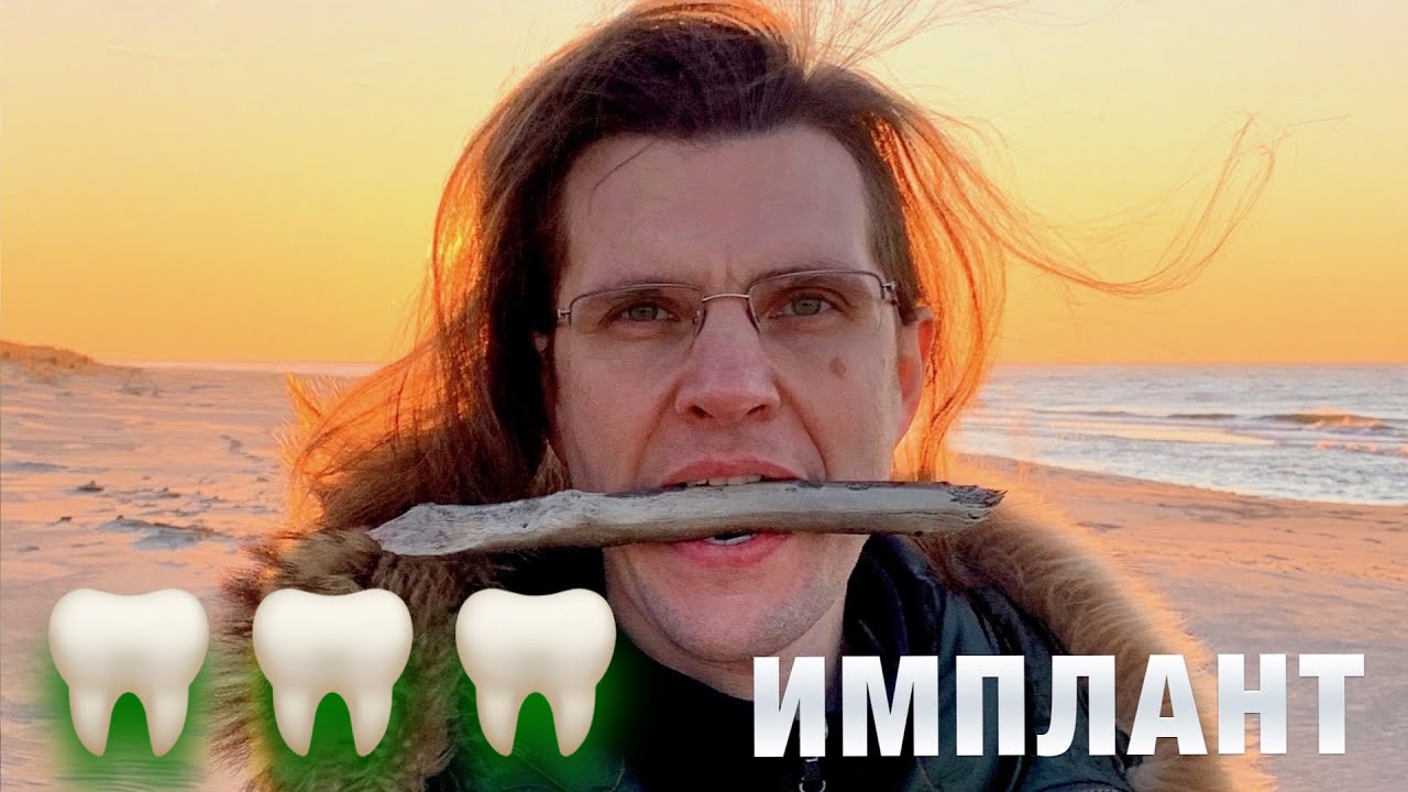 Как я имплантировал зубы и остался доволен