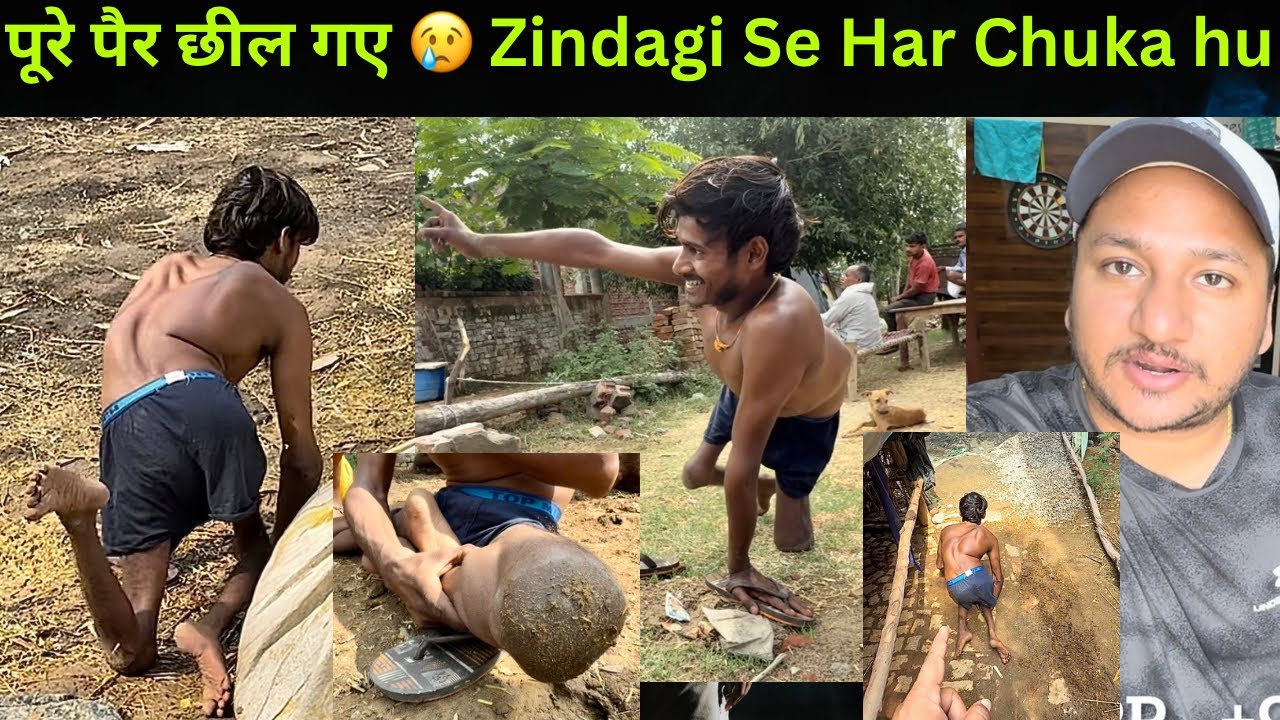 Shocking - 22 Saal Se Road Par Ghis Ke Chal Raha Hu 🥺 Kisi Ne Help Nhi Ki 😢  @sandeepbhatt