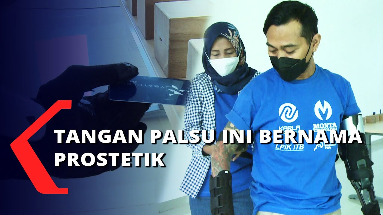 Tangan Palsu dari Bandung Bantu Difabel