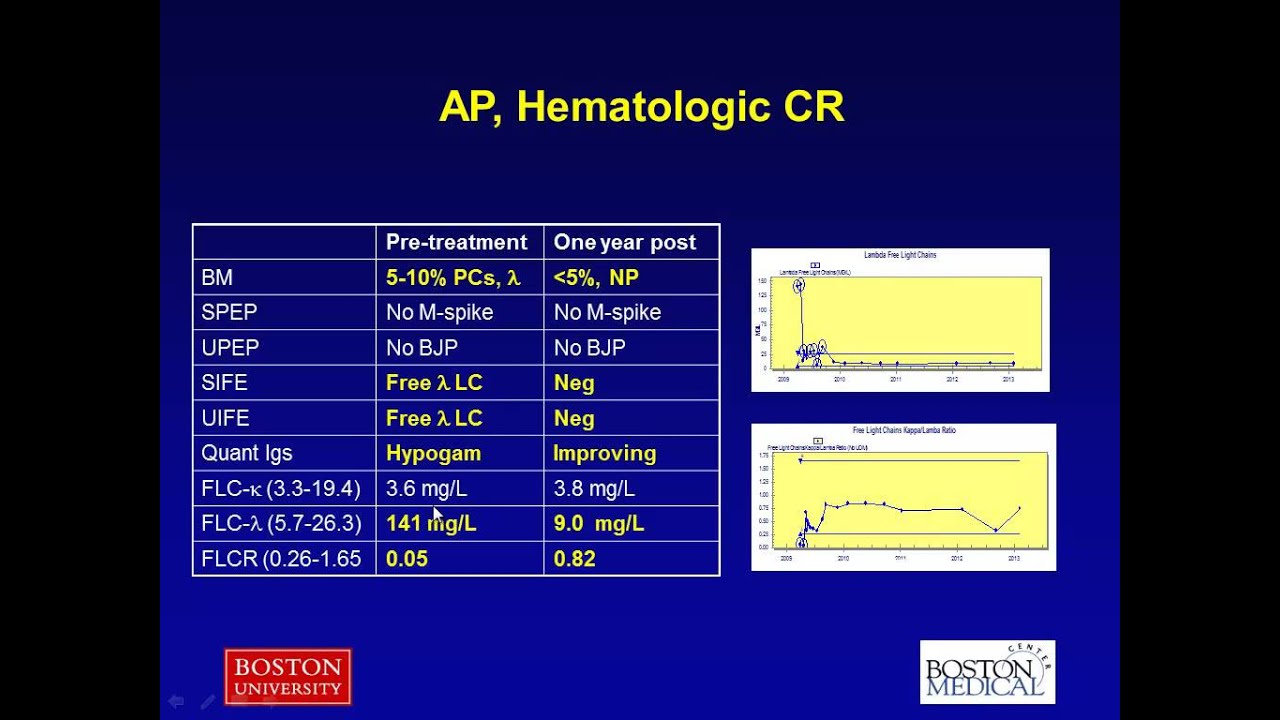 Diagnoses and Treatment of Systemic Amyloidosis