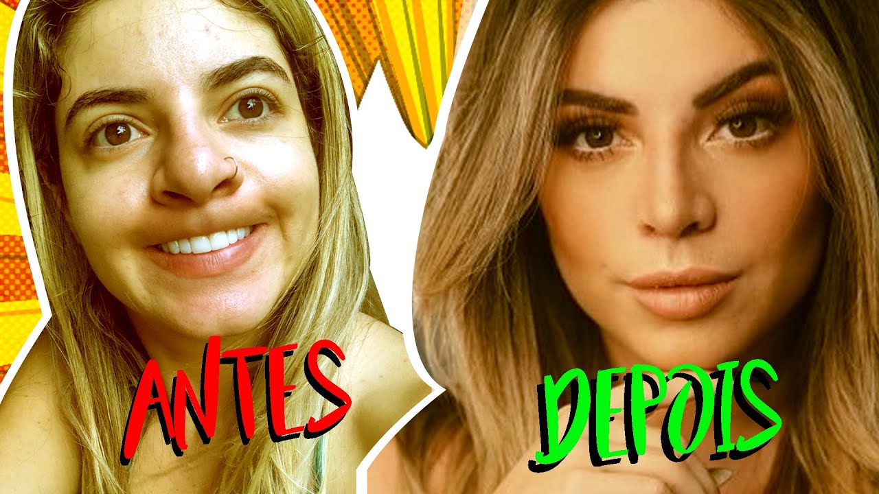TUDO SOBRE MINHA RINOPLASTIA