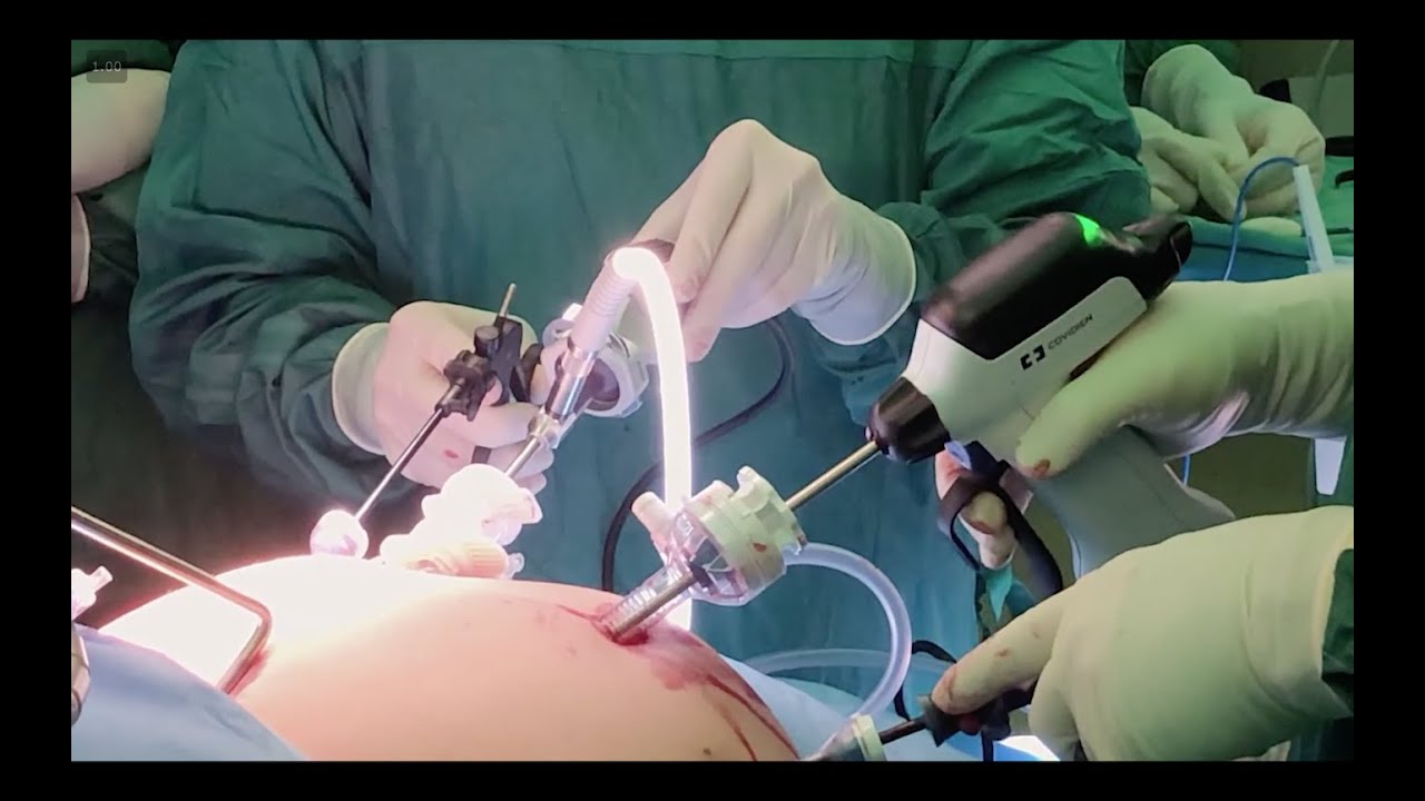 How to be a Third Year Medical Student in the OR