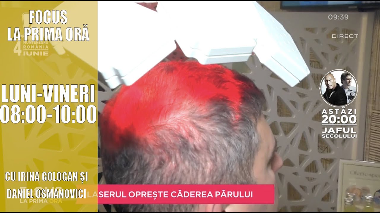 TRATAMENTUL CU LASER CARE OPREȘTE CĂDEREA PĂRULUI. SĂNĂTATE CU STIL CU LUCIANA INDRE
