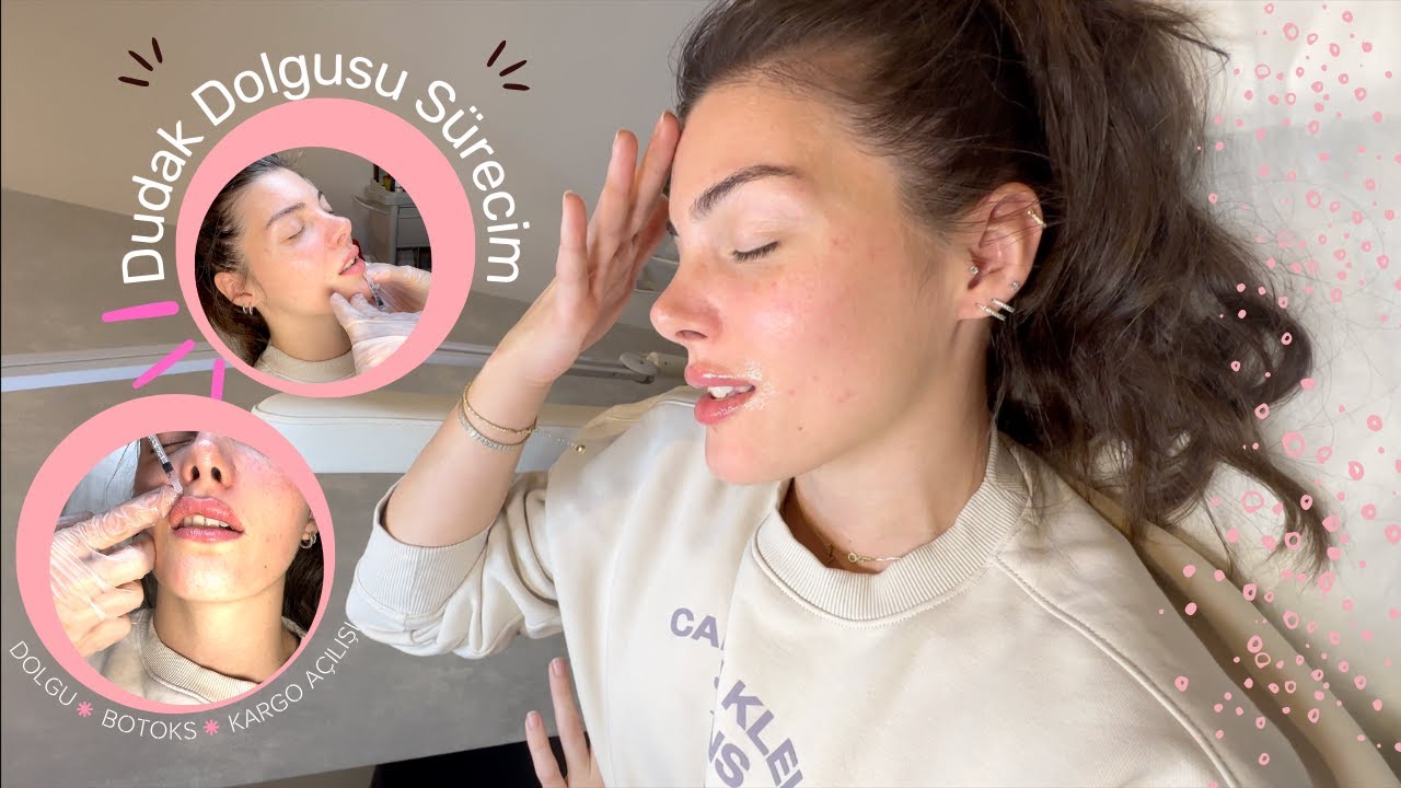 Dudak Dolgusu ve Botoks Yaptırdım | Tüm Süreç, Kargo Açılışı