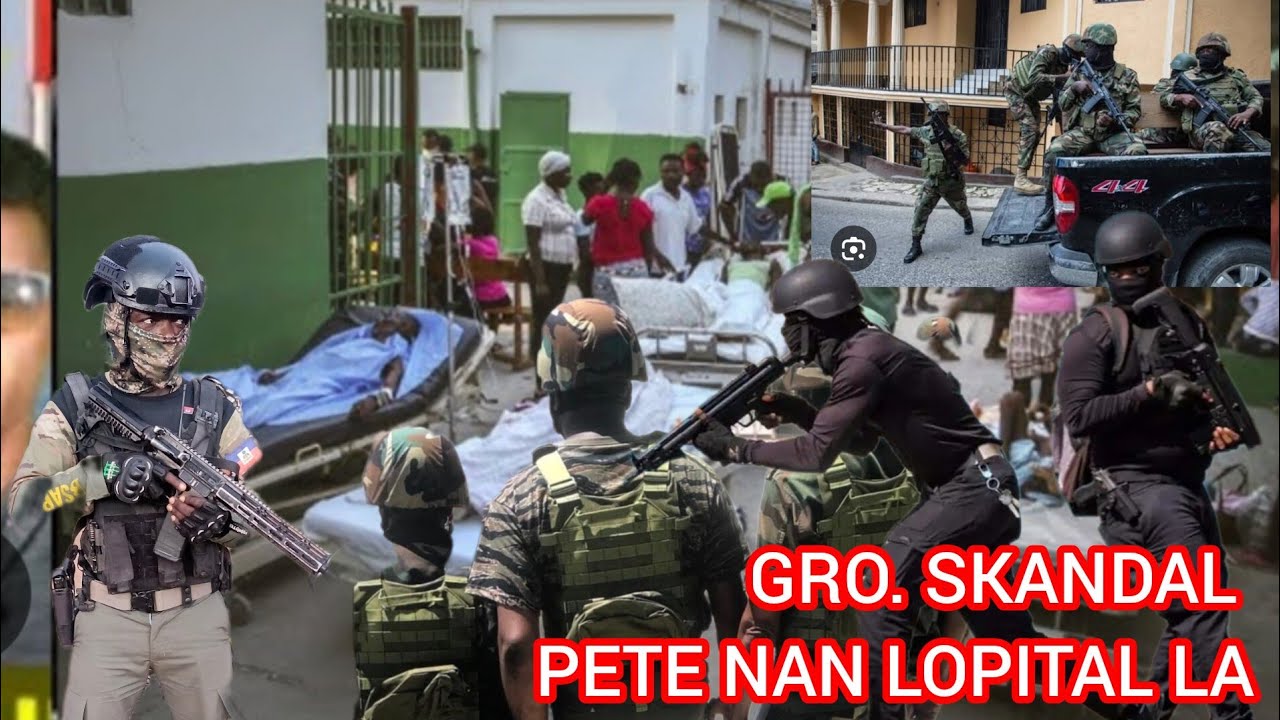 MOVÈZ NOUVEL SKANDAL PETE ANDAN LOPITAL LETA KI WANAMENT LAN PASYAN PAKA JWEN SWEN SIW PA BAY AVANS