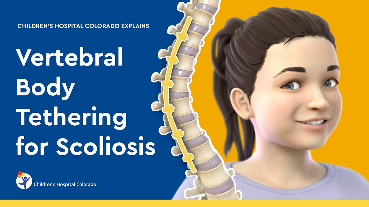 Vertebral Body Tethering
