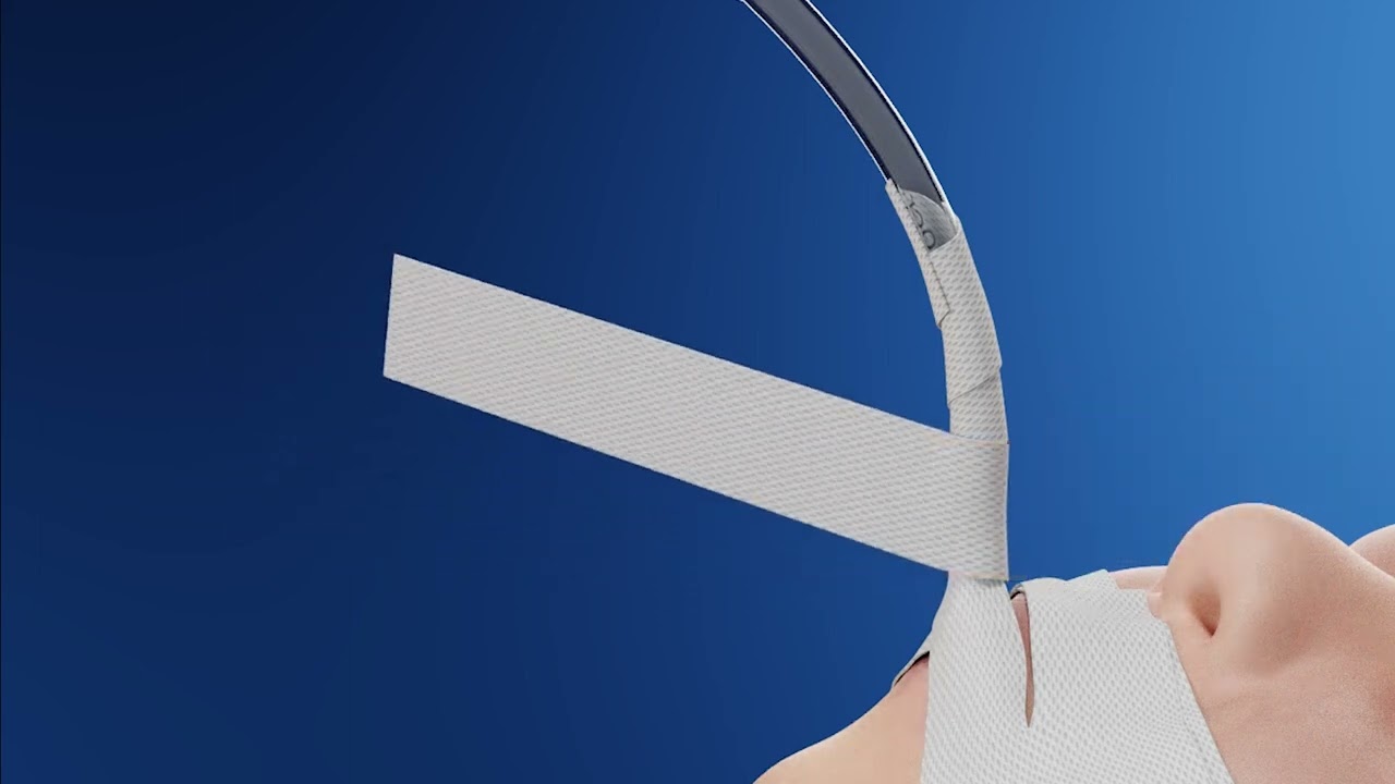 Endotracheal Tube Securement - Demonstration of Pants Technique