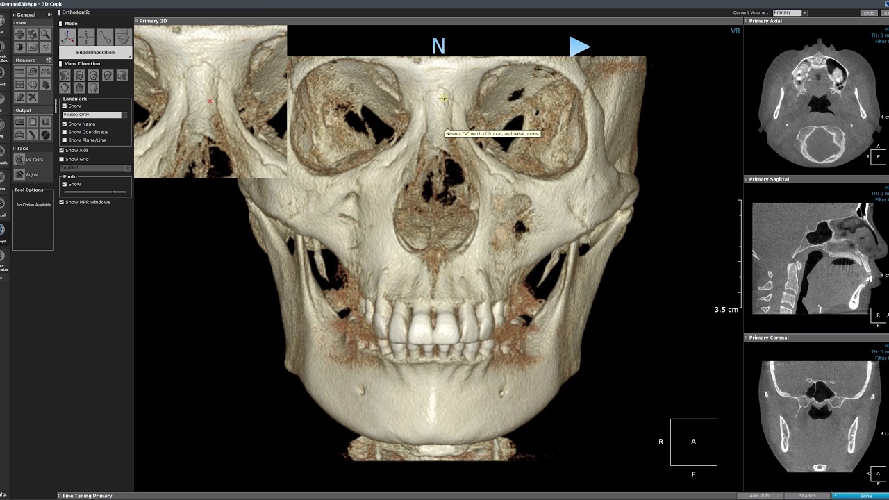 3D Ceph compare