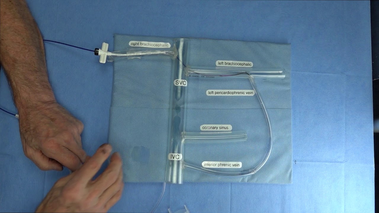 Respicardia Implant Part 2 Interventional approach to placing lead in left pericardiophrenic vein