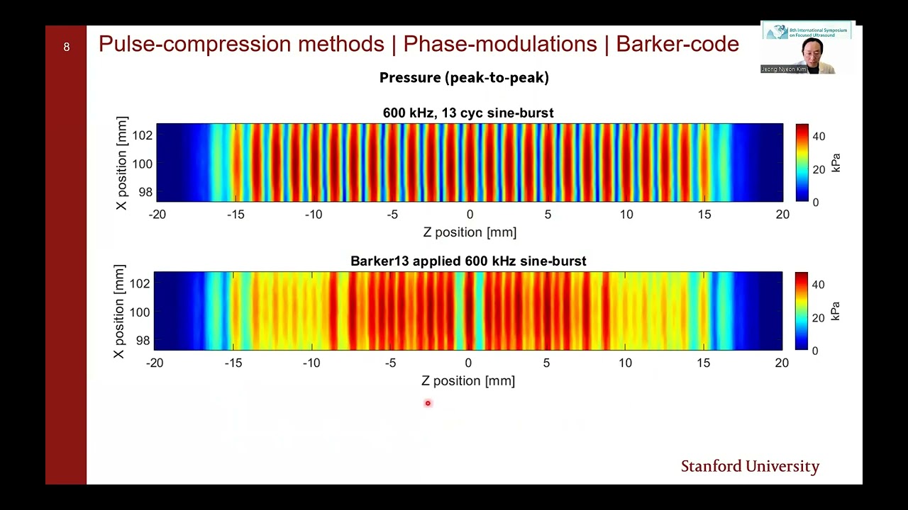Jeong Nyeon Kim: Radiation Force for High-Spatial-Resolution Transcranial FUS Neuromodulation