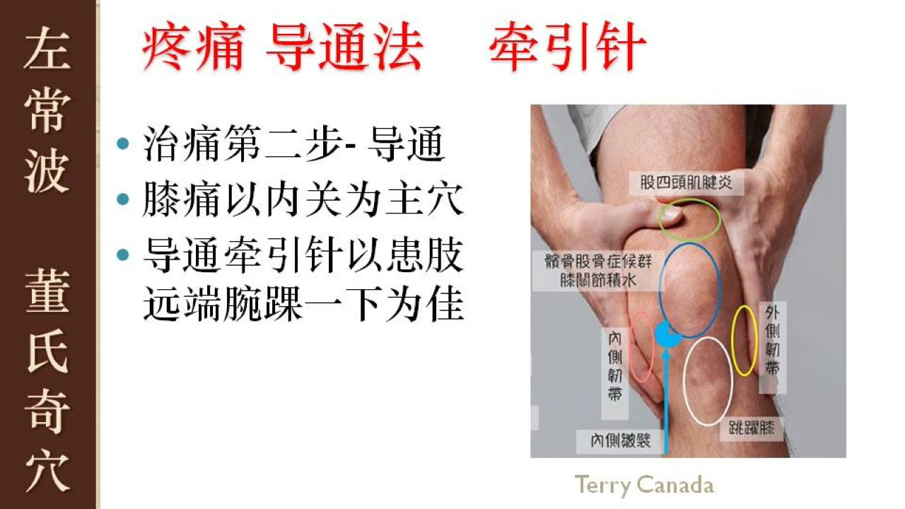 2.3 疼痛 导通法 | 左常波 董氏奇穴 | Master Tung Acupuncture Points