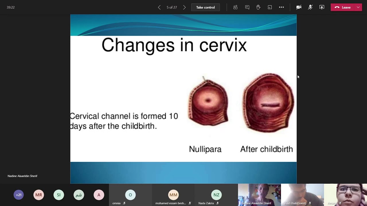 19) Normal and Abnormal Puerperium ( online ) 26/1/2021