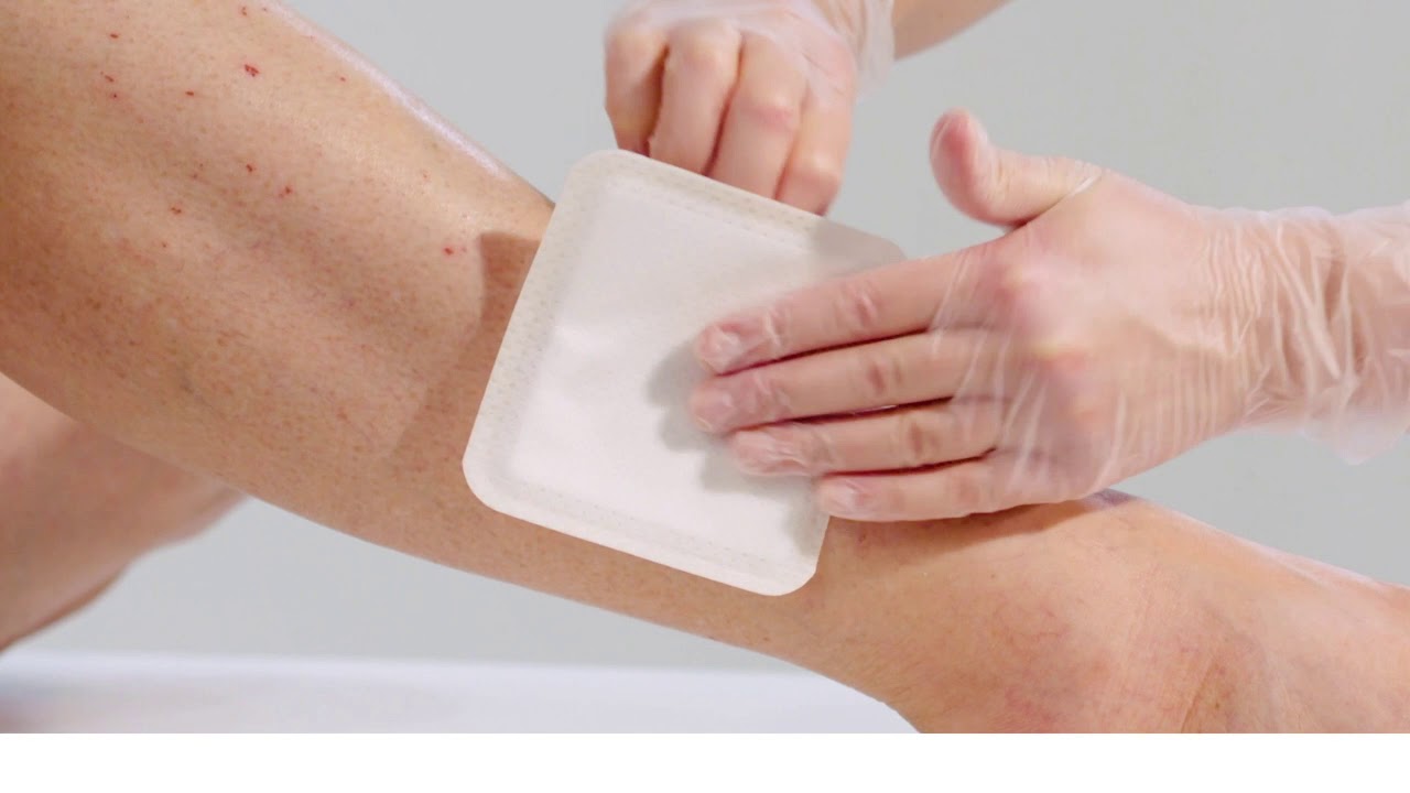 UrgoStart Plus / Ulcus cruris & Diabetisches Fu&szlig;syndrom / Einfach & zeitsparend