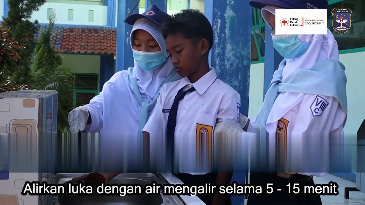 Pertolongan Pertama  LUKA BAKAR
