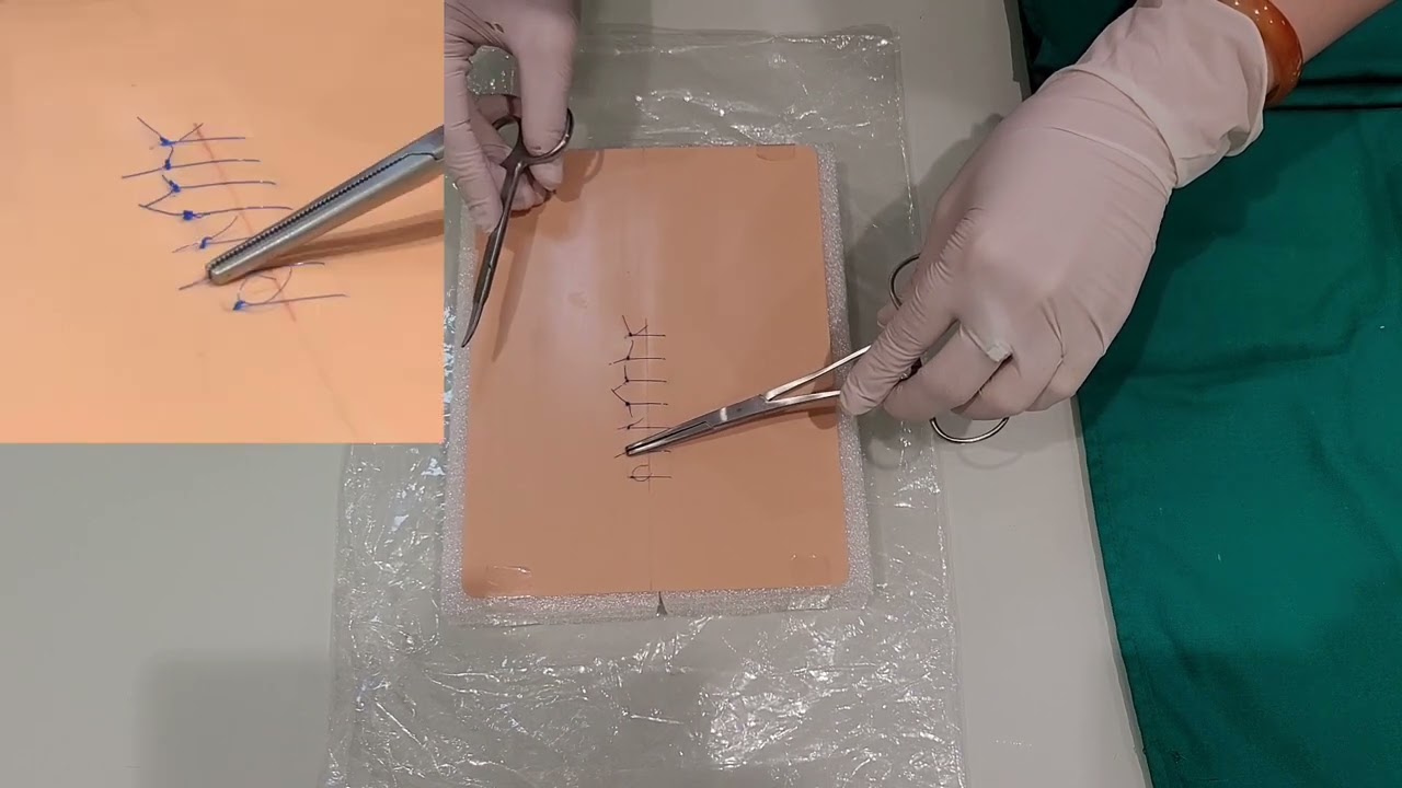 [WOUND CARE] Cắt chỉ vết thương | ĐiềuDưỡng•FYR