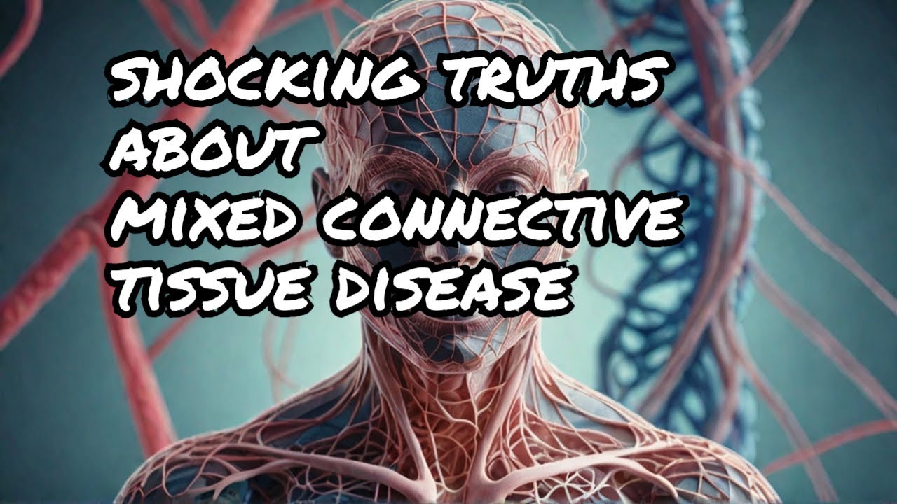 Shocking Truths About Mixed Connective Tissue Diseases