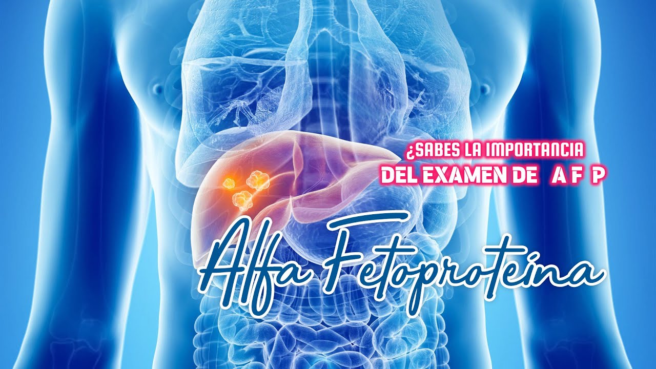 Examen AFP Alfa Fetoproteína: Detección Temprana de Cáncer | DayerLab