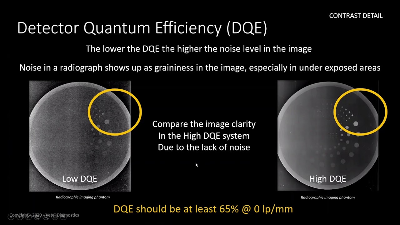 Secrets to Assessing True Quality in Digital Radiography Systems.