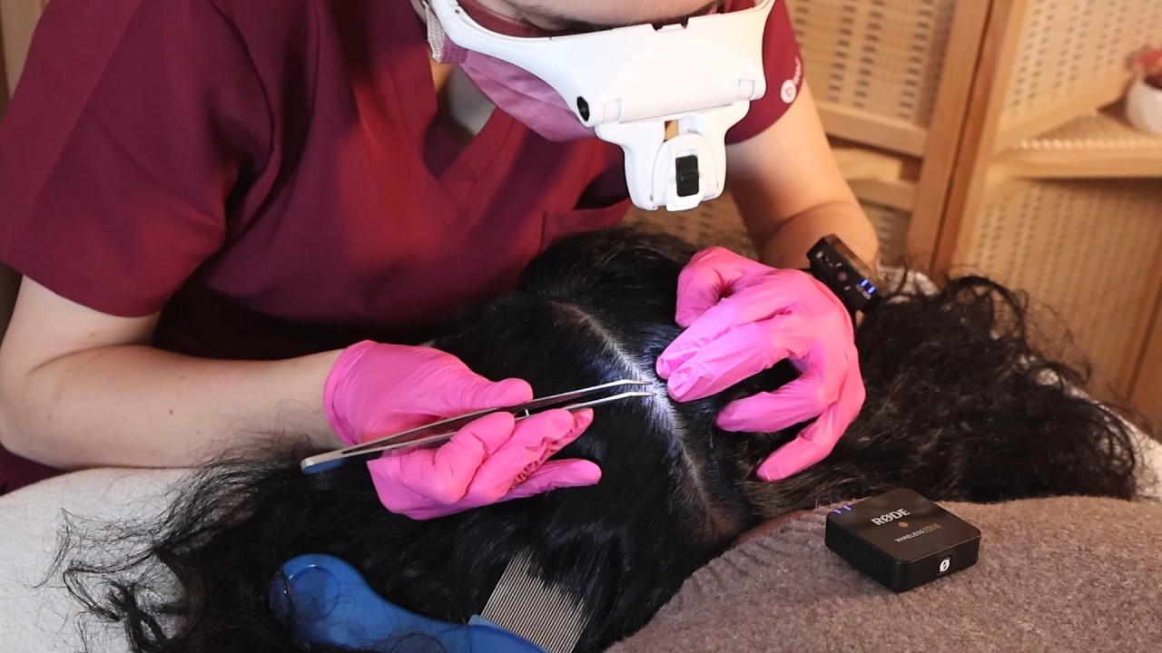 ASMR School Nurse LICE Check on Scalp and Neck | Removal with Tweezers
