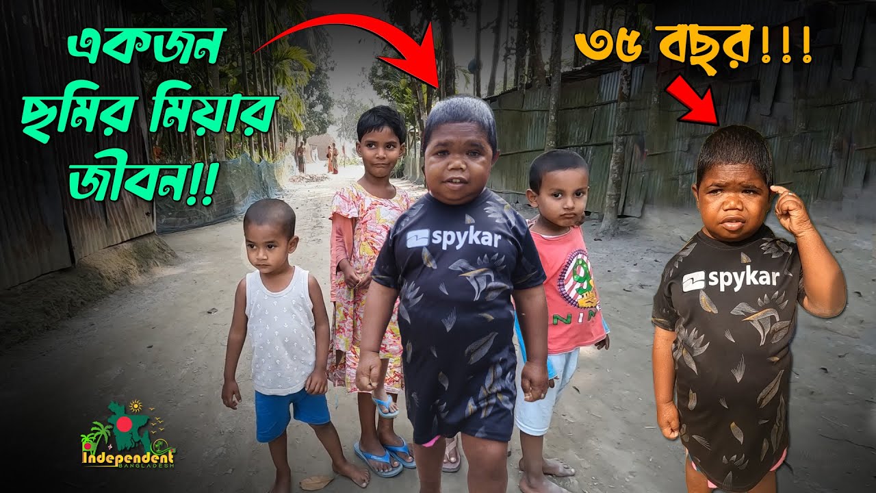 ৩৫ বছর বয়সে এখনও সে শিশু! একজন ছমির  মিয়ার জীবন!