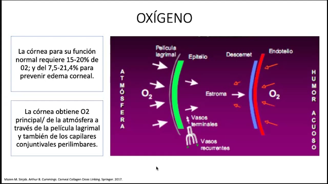 Actualización en Cross-Linking Corneal