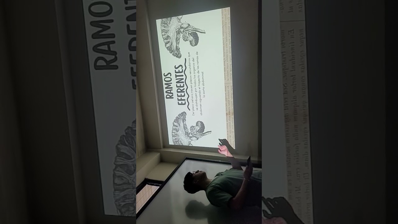 Plexo solar/presentacion de muchachos