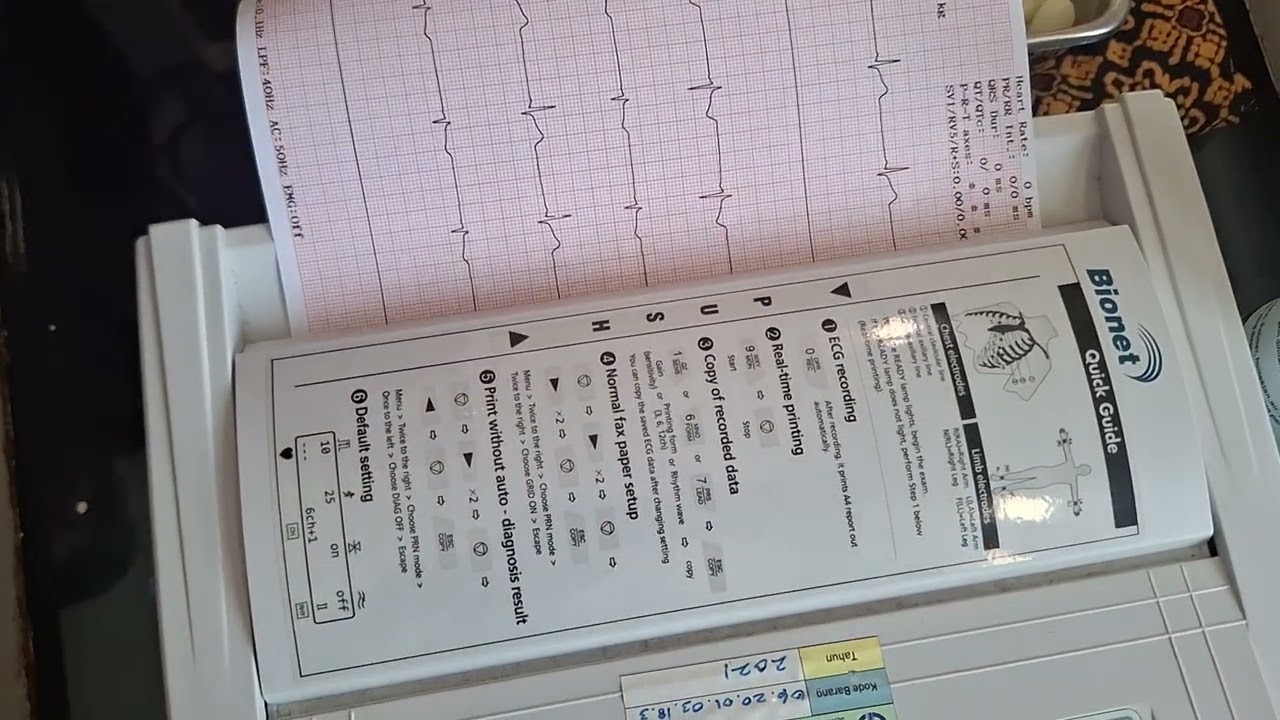 Ekg