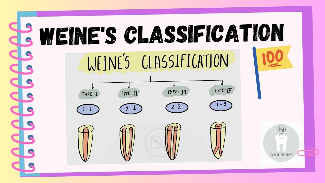 Weine's classification for Root Canal- Simplified 