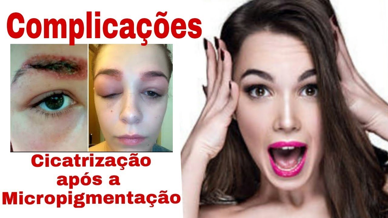 COMPLICAÇÕES NA CICATRIZAÇÃO APÓS A MICROPIGMENTAÇÃO