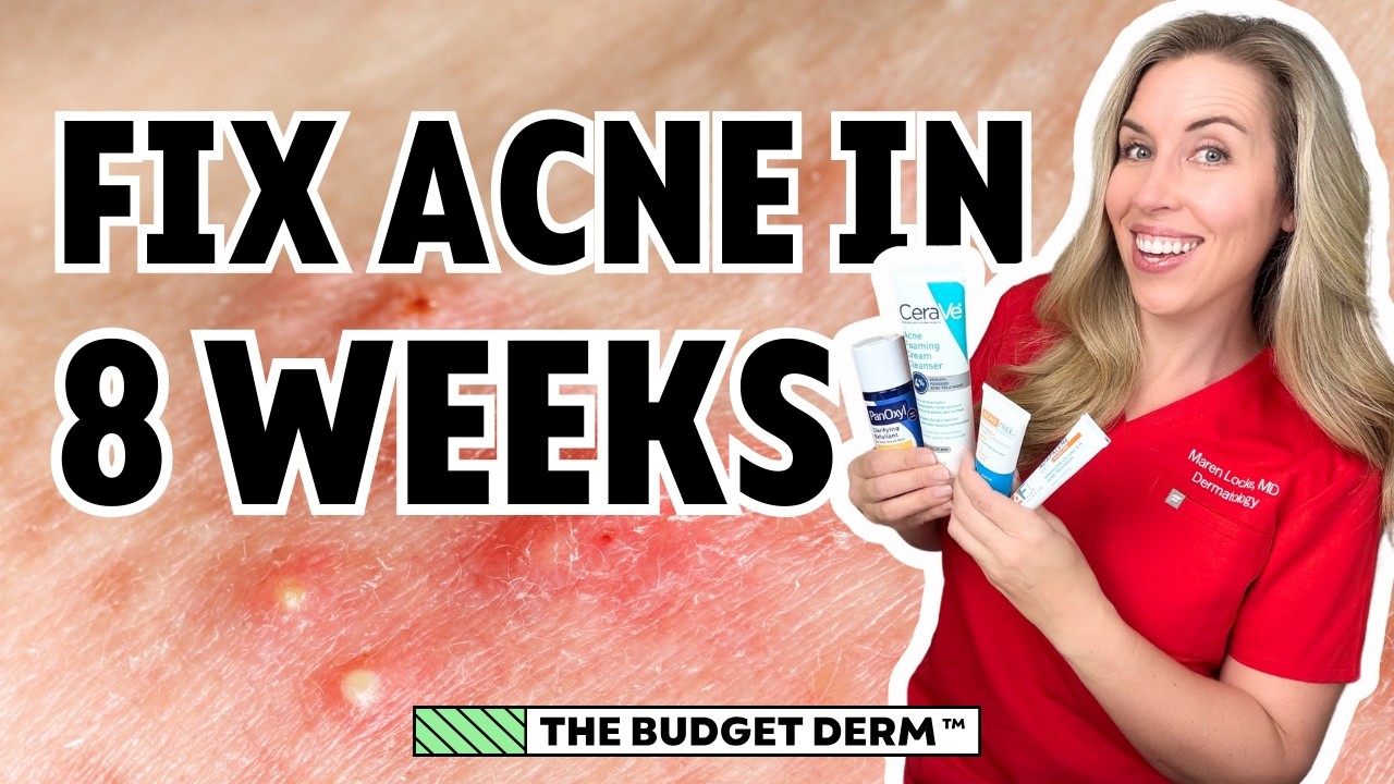 Fix Acne In 8 Weeks! | Step-by-Step Skincare Routine by The Budget Derm