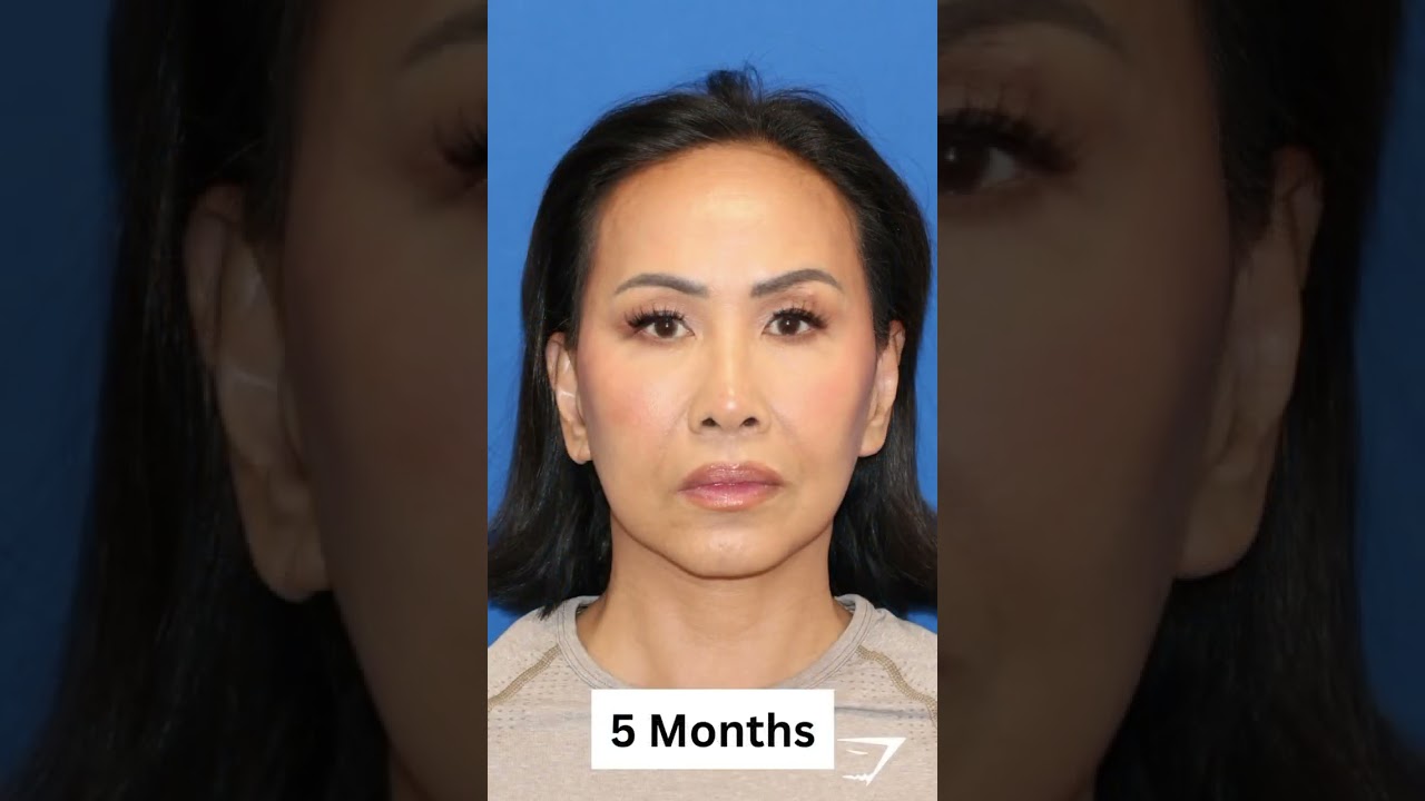 62 Year Old Woman LOOKS 20 YEARS YOUNGER!