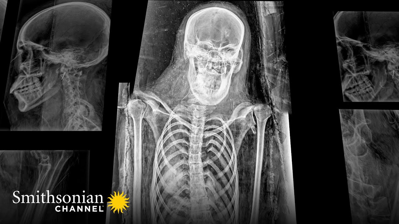 X-Ray of an Ancient Mummy Reveals Details of Noblewoman's Life 💀  | Smithsonian Channel