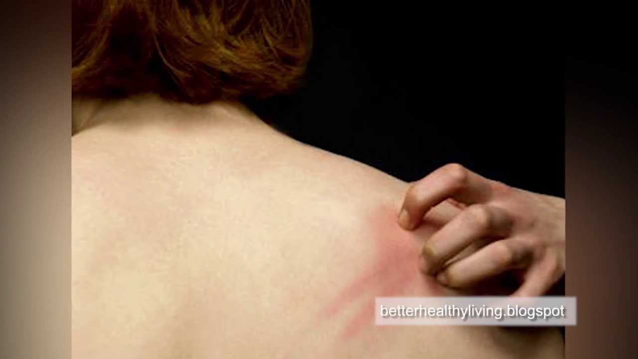Scientists unlock the secret to scratching: What makes you itch?