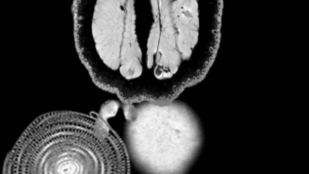 Pretty Produce - MRIs of Fruit and Vegetables