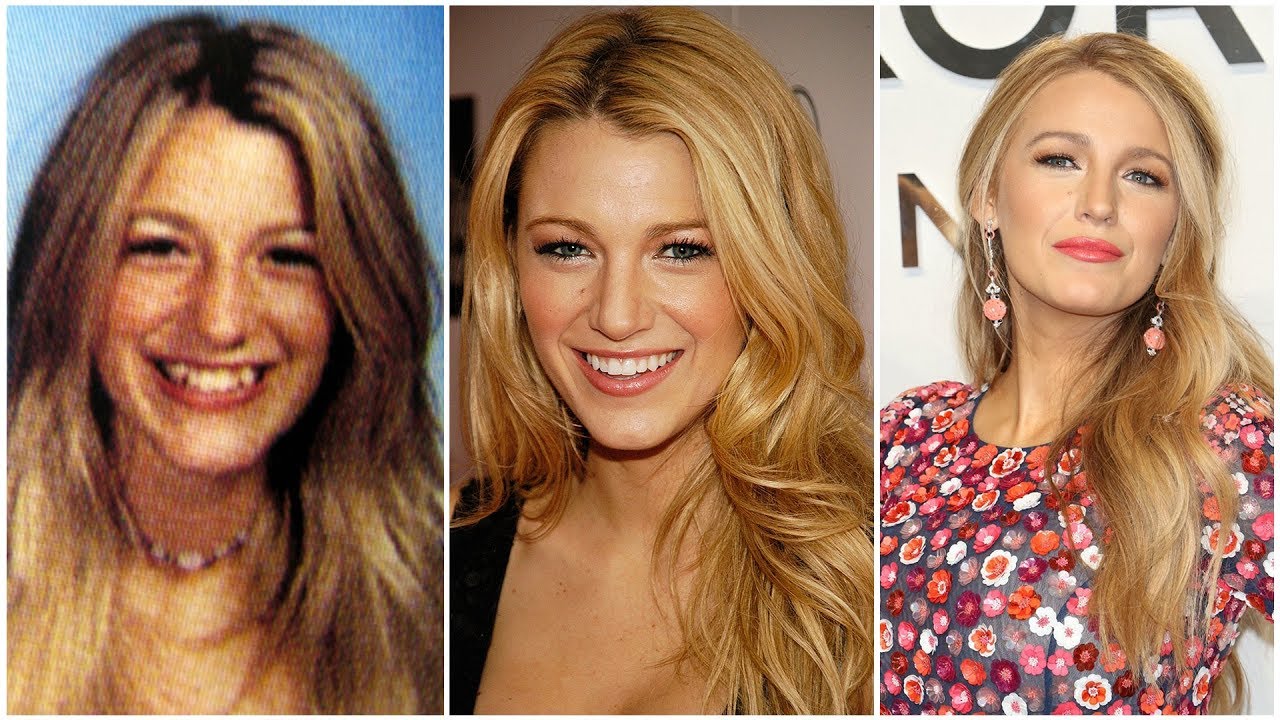 Blake Lively - From 5 to 30 Years Old