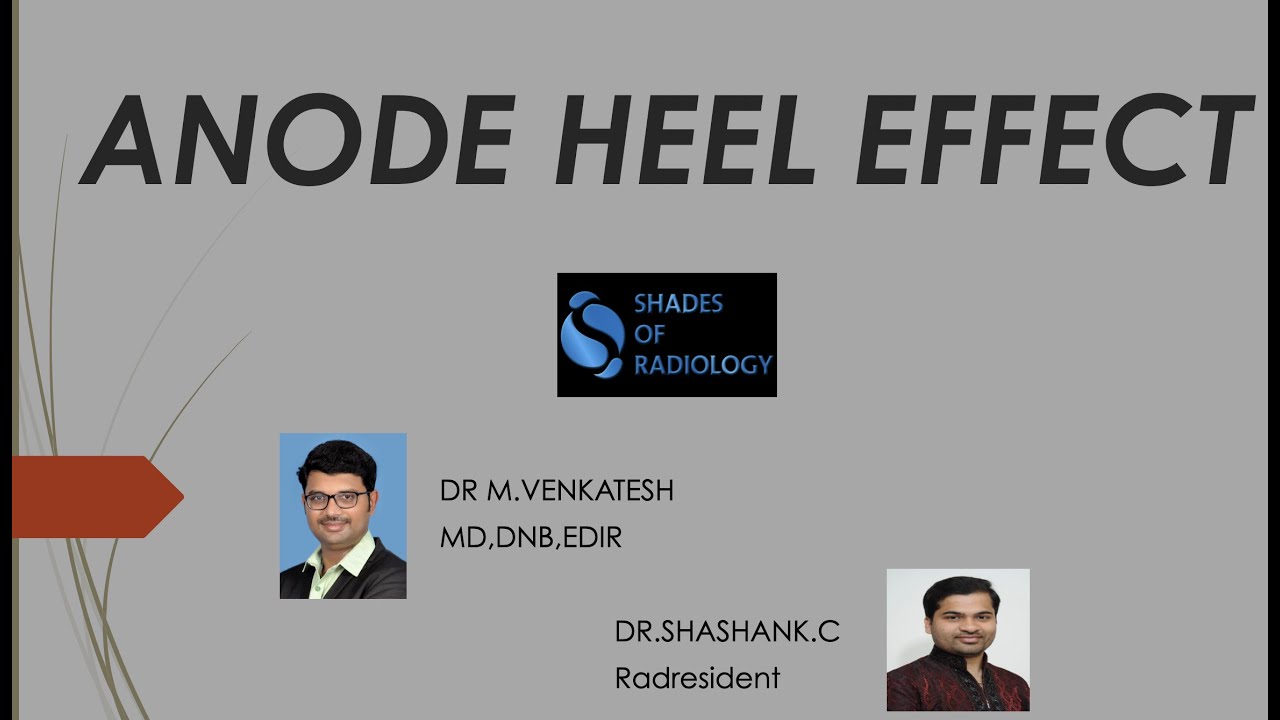 Anode heel effect- Simplified