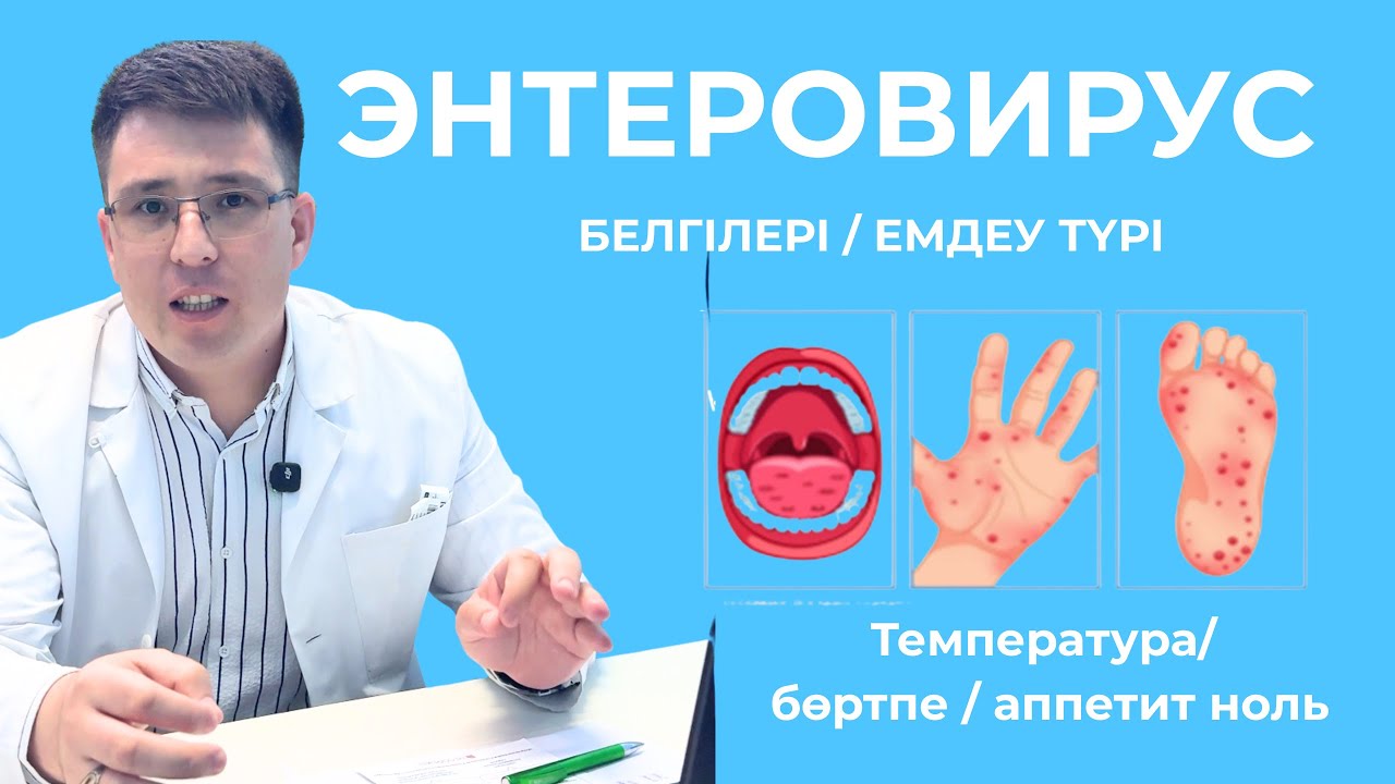 Энтеровирус қазақша / Баладағы бөртпе / температура #бөртпе #температура
