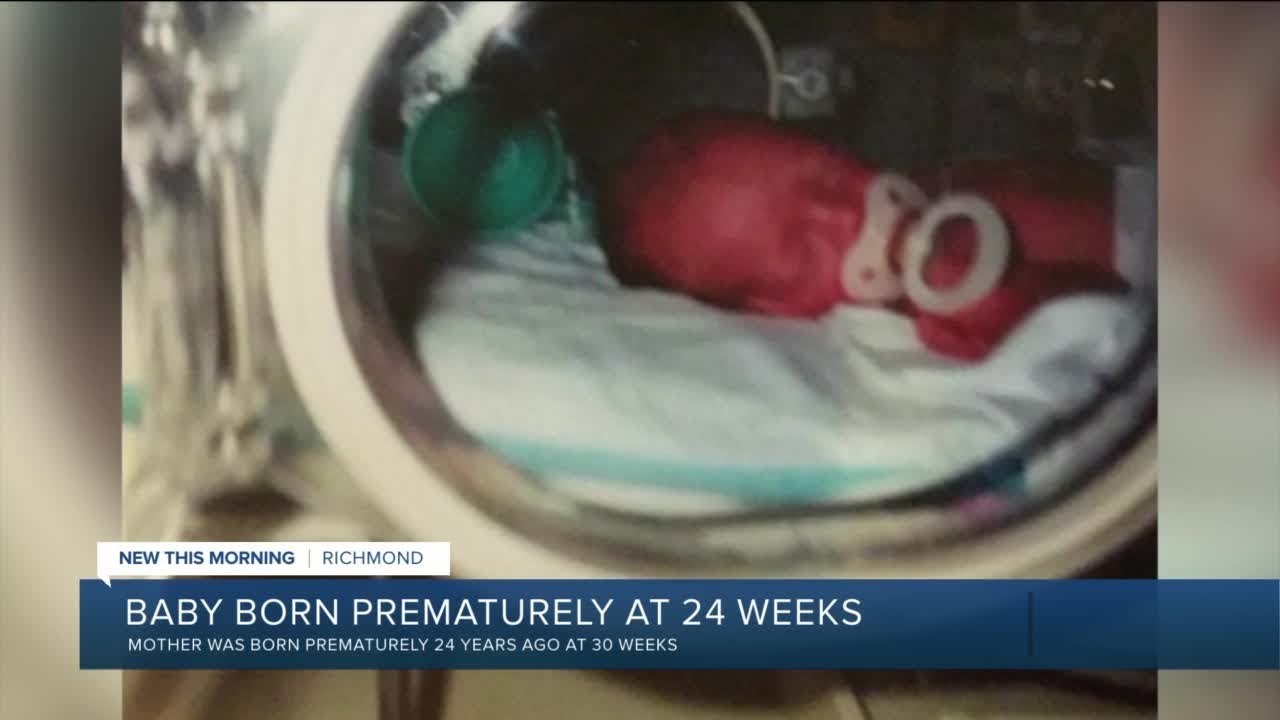 Richmond baby born at 24 weeks