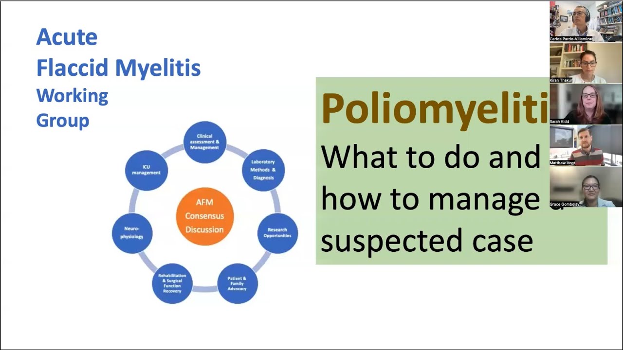 Poliomyelitis: What to do and how to manage a suspected case
