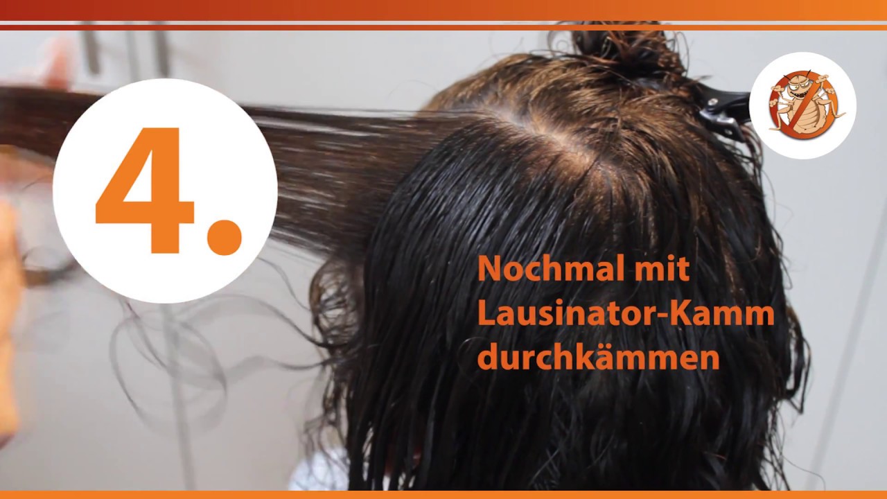 Kopfl&auml;use-Video: L&auml;use & Nissen im Haar auf dem Kopf erkennen &ndash; aktuelle Studienlage