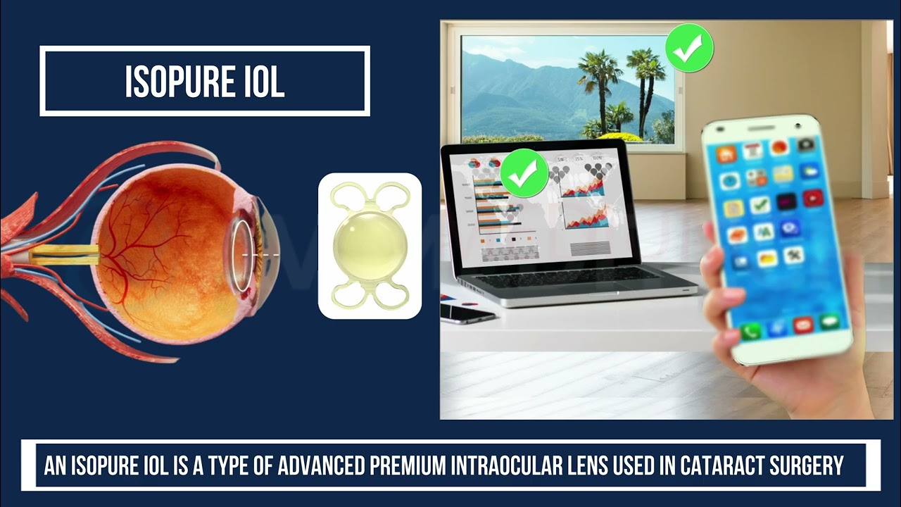 Everything You Need to Know About Intraocular Lenses (IOLs) - By BVI .