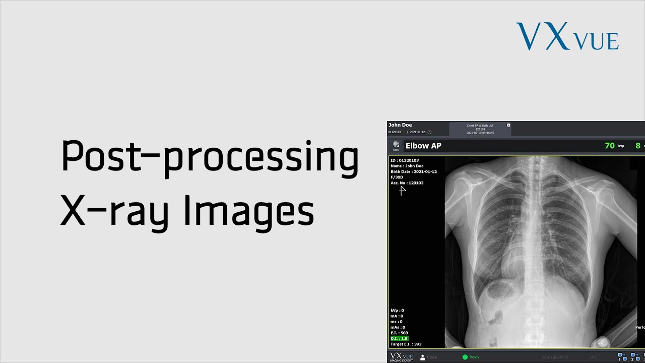 VXvue Quick Guide 03. Post-processing X-ray Images