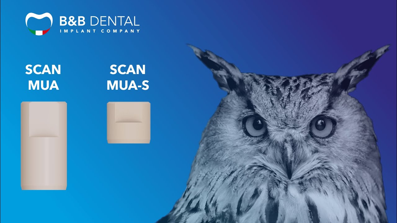 How to use scan components on MUA abutments