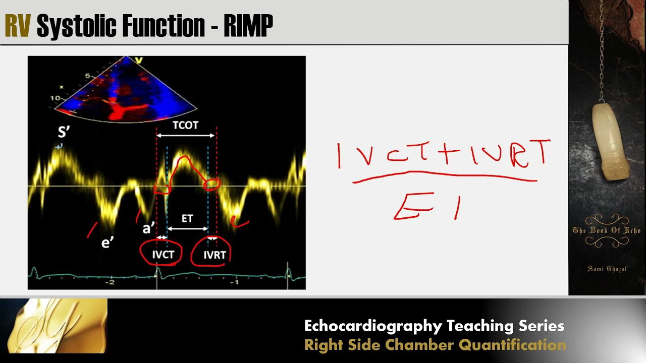 Lecture 7 - Right Side Chamber Quantification