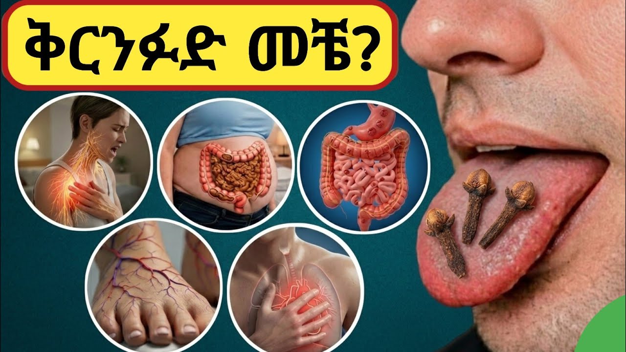 ቅርንፉድ መቆርጠምን ማስወገድ ያለባቸው ሰዎች? Who Should Avoid Chewing Cloves?