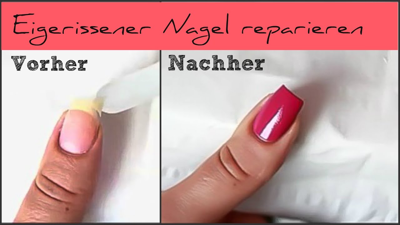 SOS - Eingerissener Nagel reparieren